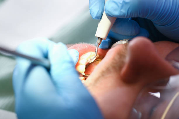Best Dentist for Tooth Abscess  in Ellisville, MO